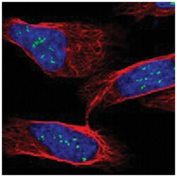 URB1, Rabbit, Polyclonal Antibody, Abnova 100 &mu;L | Buy Online | Abnova Corporation | Fisher Scientific