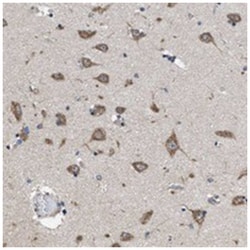 CEP128 Rabbit anti-Human, Polyclonal Antibody, Abnova 100 &mu;L | Buy Online | Abnova Corporation | Fisher Scientific