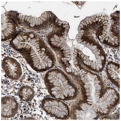 CSRNP2, Rabbit, Polyclonal Antibody, Abnova 100&mu;L; Unlabeled:Antibodies,