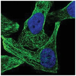SPIB, Rabbit, Polyclonal Antibody, Abnova 100 &mu;L | Buy Online | Abnova Corporation | Fisher Scientific