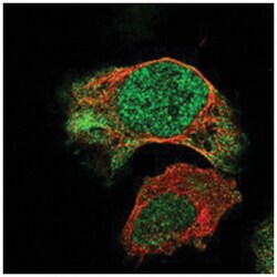 BNC2, Rabbit, Polyclonal Antibody, Abnova 100 &mu;L | Buy Online | Abnova Corporation | Fisher Scientific