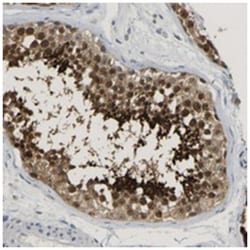 TXNDC2, Rabbit, Polyclonal Antibody, Abnova 100&mu;L; Unlabeled:Antibodies,