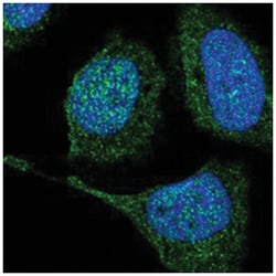 TXNDC2, Rabbit, Polyclonal Antibody, Abnova 100&mu;L; Unlabeled:Antibodies,