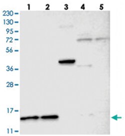 C22orf40, Rabbit, Polyclonal Antibody, Abnova 100 &mu;L | Buy Online | Abnova Corporation | Fisher Scientific