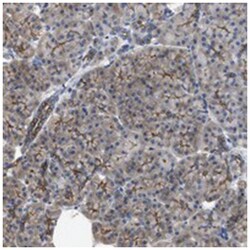 C22orf40, Rabbit, Polyclonal Antibody, Abnova 100 &mu;L | Buy Online | Abnova Corporation | Fisher Scientific