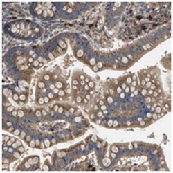 RNF216 Rabbit anti-Human, Polyclonal Antibody, Abnova 100 &mu;L | Buy Online | Abnova Corporation | Fisher Scientific