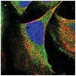 RNF216 Rabbit anti-Human, Polyclonal Antibody, Abnova 100 &mu;L | Buy Online | Abnova Corporation | Fisher Scientific