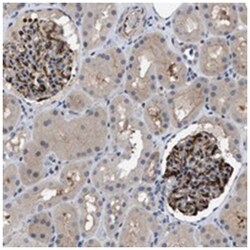 IL17RE Rabbit anti-Human, Polyclonal Antibody, Abnova 100&mu;L; Unlabeled:Antibodies,
