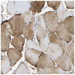 TET1, Rabbit, Polyclonal Antibody, Abnova 100 &mu;L | Buy Online | Abnova Corporation | Fisher Scientific