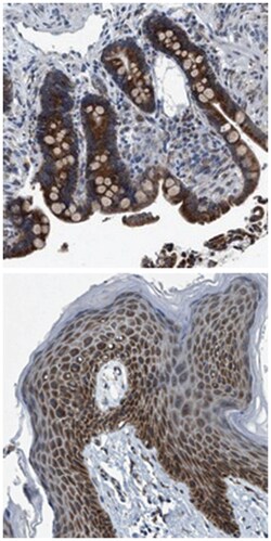 ARMC9 Rabbit anti-Human, Polyclonal Antibody, Abnova 100 &mu;L | Buy Online | Abnova Corporation | Fisher Scientific