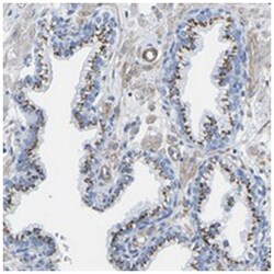 SLC45A3 Rabbit anti-Human, Polyclonal Antibody, Abnova 100 &mu;L | Buy Online | Abnova Corporation | Fisher Scientific