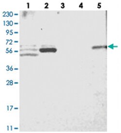 PPM2C Rabbit anti-Human, Polyclonal Antibody, Abnova 100 &mu;L | Buy Online | Abnova Corporation | Fisher Scientific