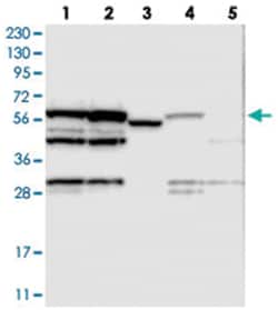 MPP6 Rabbit anti-Human, Polyclonal Antibody, Abnova 100&mu;L; Unlabeled:Antibodies,
