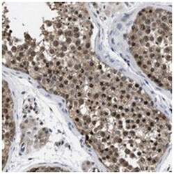 MCOLN2, Rabbit, Polyclonal Antibody, Abnova 100 &mu;L | Buy Online | Abnova Corporation | Fisher Scientific