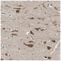 YAE1D1, Rabbit, Polyclonal Antibody, Abnova 100&mu;L; Unlabeled:Antibodies,