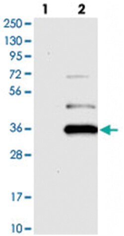 YAE1D1, Rabbit, Polyclonal Antibody, Abnova 100&mu;L; Unlabeled:Antibodies,