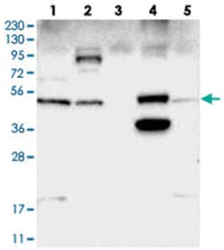 SNX30, Rabbit, Polyclonal Antibody, Abnova 100 &mu;L | Buy Online | Abnova Corporation | Fisher Scientific