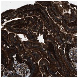 SNX30, Rabbit, Polyclonal Antibody, Abnova 100 &mu;L | Buy Online | Abnova Corporation | Fisher Scientific