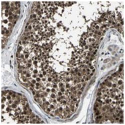 ANKIB1, Rabbit, Polyclonal Antibody, Abnova 100 &mu;L | Buy Online | Abnova Corporation | Fisher Scientific