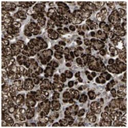 C7orf29, Rabbit, Polyclonal Antibody, Abnova 100&mu;L; Unlabeled:Antibodies,