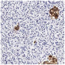 DGCR2, Rabbit, Polyclonal Antibody, Abnova 100&mu;L; Unlabeled:Antibodies,