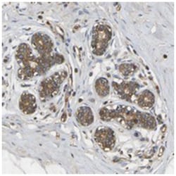 METTL21D, Rabbit, Polyclonal Antibody, Abnova 100 &mu;L | Buy Online | Abnova | Fisher Scientific