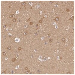 ATG2B Rabbit anti-Human, Polyclonal Antibody, Abnova 100 &mu;L | Buy Online | Abnova Corporation | Fisher Scientific