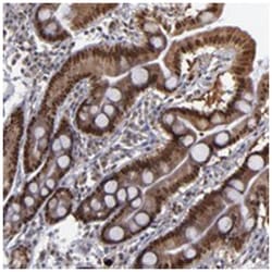 RREB1, Rabbit, Polyclonal Antibody, Abnova 100&mu;L; Unlabeled:Antibodies,