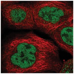 RREB1, Rabbit, Polyclonal Antibody, Abnova 100&mu;L; Unlabeled:Antibodies,