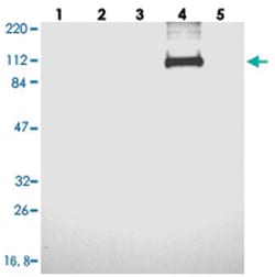 GLDC, Rabbit, Polyclonal Antibody, Abnova 100&mu;L; Unlabeled:Antibodies,