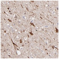 GLDC, Rabbit, Polyclonal Antibody, Abnova 100&mu;L; Unlabeled:Antibodies,