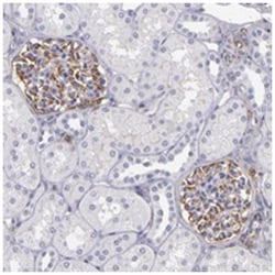 ABCC1, Rabbit, Polyclonal Antibody, Abnova 100&mu;L; Unlabeled:Antibodies,