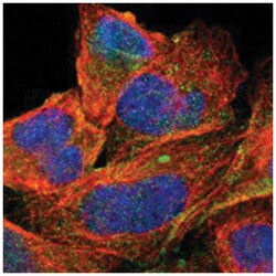 ABCC1, Rabbit, Polyclonal Antibody, Abnova 100&mu;L; Unlabeled:Antibodies,