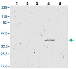 ZDHHC15, Rabbit, Polyclonal Antibody, Abnova 100&mu;L; Unlabeled:Antibodies,