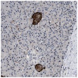 ZDHHC15, Rabbit, Polyclonal Antibody, Abnova 100&mu;L; Unlabeled:Antibodies,