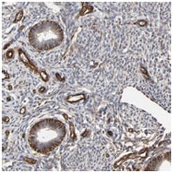 FAM118A, Rabbit, Polyclonal Antibody, Abnova 100μL; Unlabeled:Antibodies,