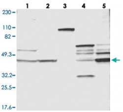 VSIG4, Rabbit, Polyclonal Antibody, Abnova 100 &mu;L | Buy Online | Abnova Corporation | Fisher Scientific