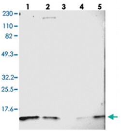 DYNLT3, Rabbit, Polyclonal Antibody, Abnova 100 &mu;L | Buy Online | Abnova Corporation | Fisher Scientific