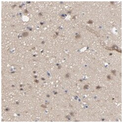 DYNLT3, Rabbit, Polyclonal Antibody, Abnova 100 &mu;L | Buy Online | Abnova Corporation | Fisher Scientific