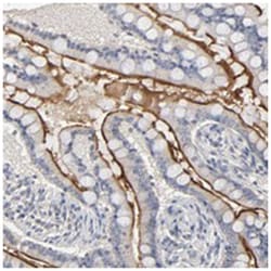 SLC10A2, Rabbit, Polyclonal Antibody, Abnova 100&mu;L; Unlabeled:Antibodies,