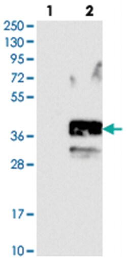 SLC10A2, Rabbit, Polyclonal Antibody, Abnova 100&mu;L; Unlabeled:Antibodies,