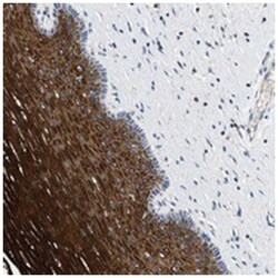 TOMM6, Rabbit, Polyclonal Antibody, Abnova 100&mu;L; Unlabeled:Antibodies,