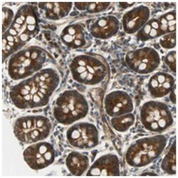 KIAA1217, Rabbit, Polyclonal Antibody, Abnova 100 &mu;L | Buy Online | Abnova Corporation | Fisher Scientific