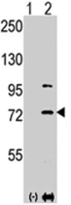 PAK1 Rabbit anti-Human, Polyclonal Antibody, Abnova 400 &mu;L | Buy Online | Abnova Corporation | Fisher Scientific