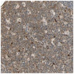 QSER1, Rabbit, Polyclonal Antibody, Abnova 100 &mu;L | Buy Online | Abnova Corporation | Fisher Scientific