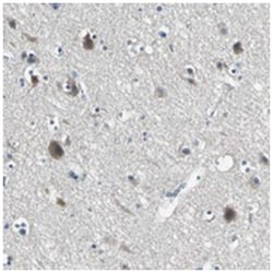 SLC16A7 Rabbit anti-Human, Polyclonal Antibody, Abnova 100 &mu;L | Buy Online | Abnova Corporation | Fisher Scientific