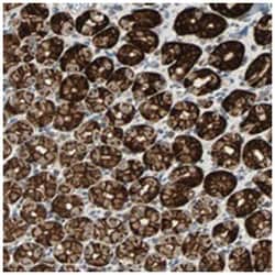 CMC2, Rabbit, Polyclonal Antibody, Abnova 100 &mu;L | Buy Online | Abnova | Fisher Scientific