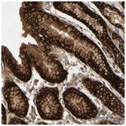 FHDC1, Rabbit, Polyclonal Antibody, Abnova 100 &mu;L | Buy Online | Abnova Corporation | Fisher Scientific