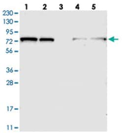 TBC1D15 Rabbit anti-Human, Mouse, Rat, Polyclonal Antibody, Abnova 100&mu;L;