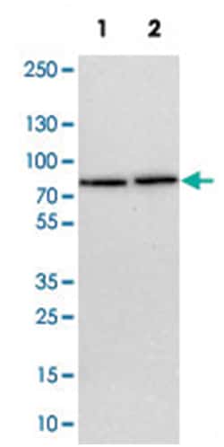 TBC1D15 Rabbit anti-Human, Mouse, Rat, Polyclonal Antibody, Abnova 100&mu;L;